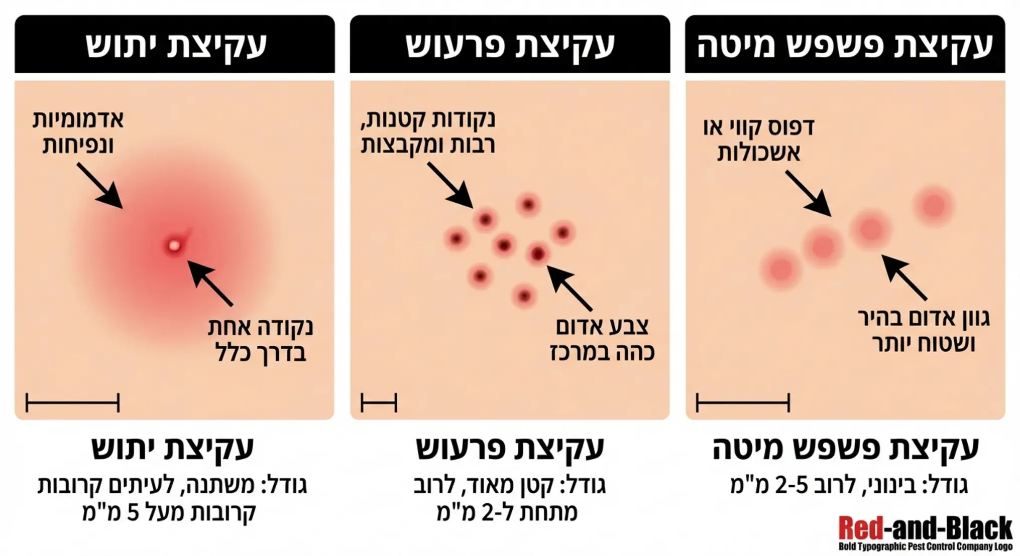 אינפוגרפיקה ויזואלית המשווה בין צורת העקיצה של יתוש, פרעוש ופשפש מיטה זו לצד זו עם חצים המסבירים את ההבדלים בגודל ובצבע