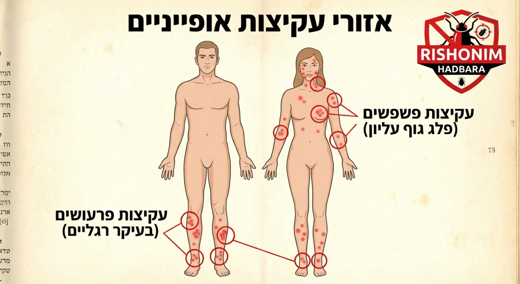 איור הממחיש את גוף האדם ומסמן באדום את האזורים האופייניים לעקיצות פרעושים (רגליים) לעומת פשפשים (פלג גוף עליון)